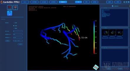 生物流體力學賦能精準醫療，晟視科技近億元Pre-A輪融資引領超聲技術創新